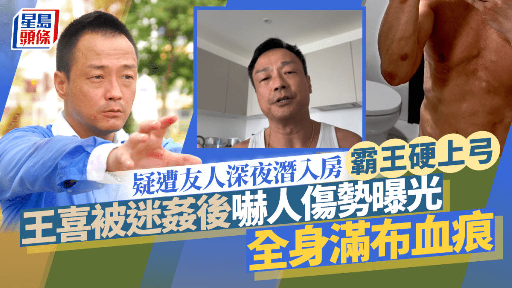 王喜被迷姦後嚇人傷勢曝光   疑遭友人深夜潛入房霸王硬上弓  全身布滿血痕  