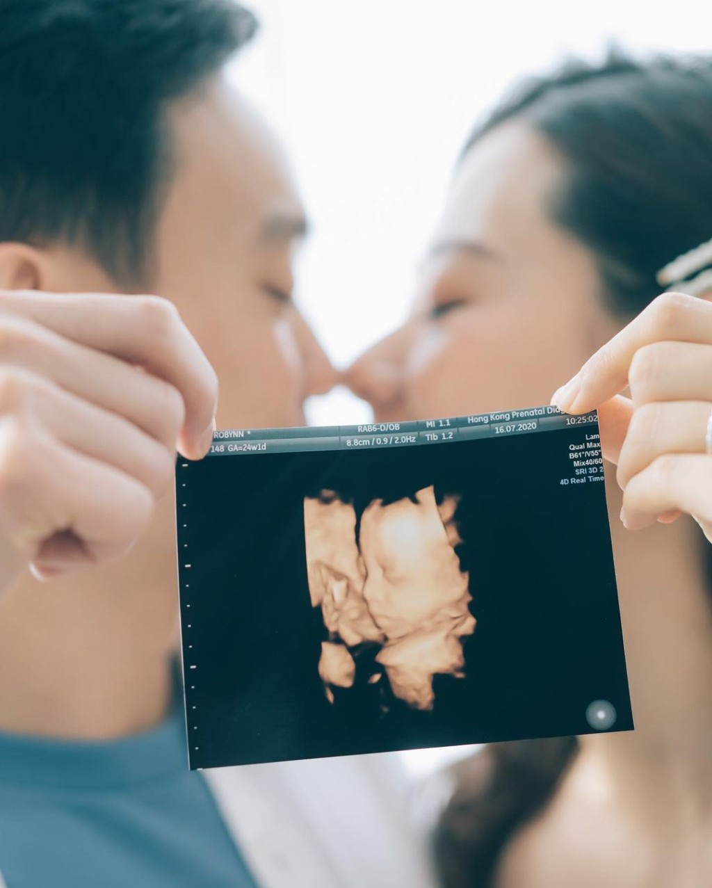 叶晴晴去年结婚，今年与老公荣升爸妈。