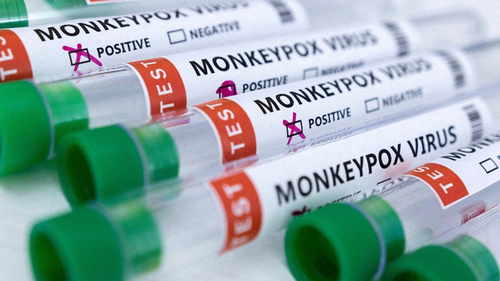 美國懷俄明州發現猴痘確診個案。路透社資料圖片