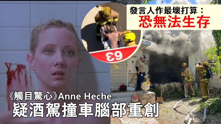 《觸目驚心》Anne Heche疑酒駕撞車腦部受創,發言人作最壞打算:「恐無法生存。」