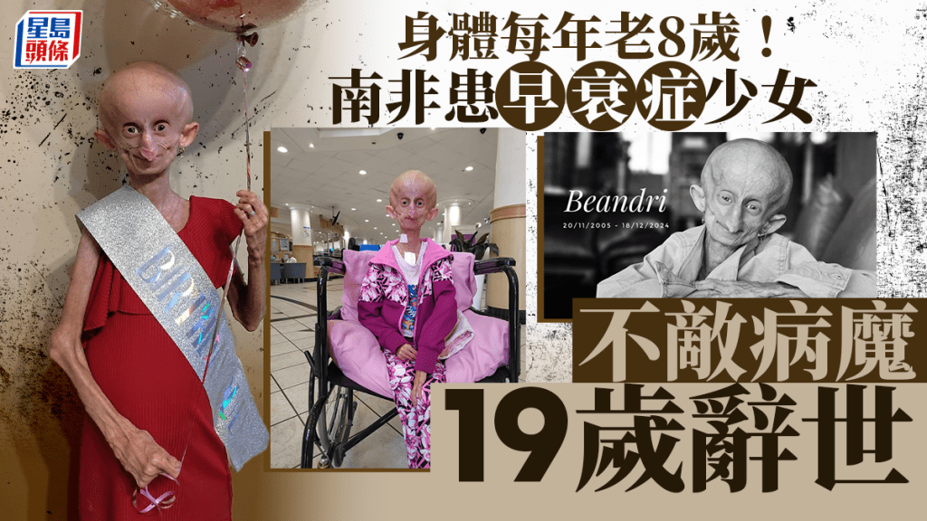 南非少女班德莉（Beandri Booysen）患有罕見疾病「早衰症」。