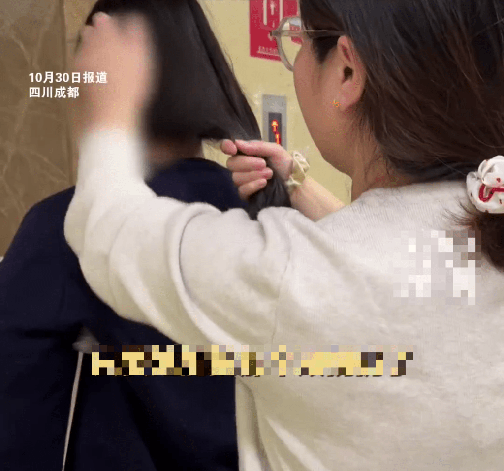 骨溶症女生母親希望手術成功令她可以自理。 紅星新聞 骨溶症女生母親希望手術成功令她可以自理。 紅星新聞