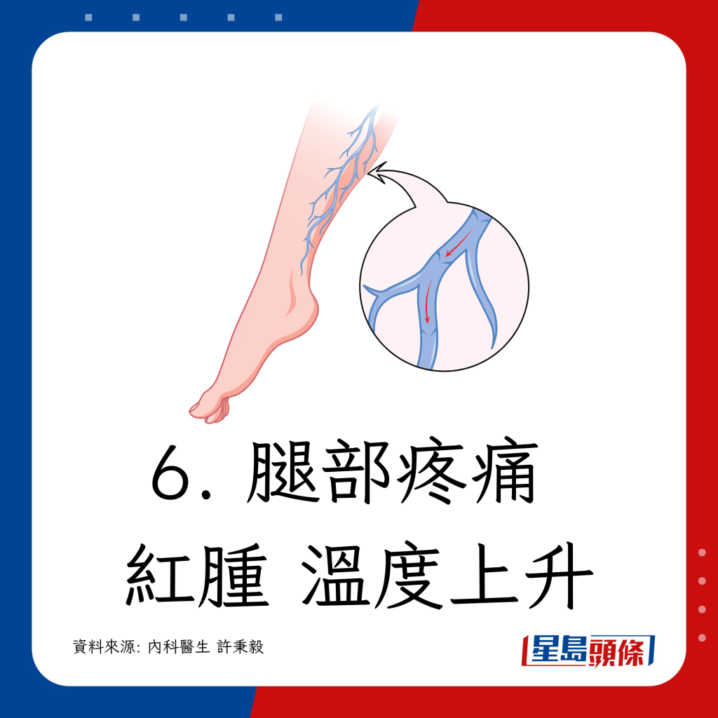 6. 腿部疼痛 紅腫 溫度上升