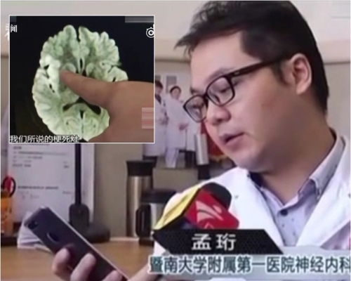 醫生指患者是長時間保持同一個姿勢。網上圖片