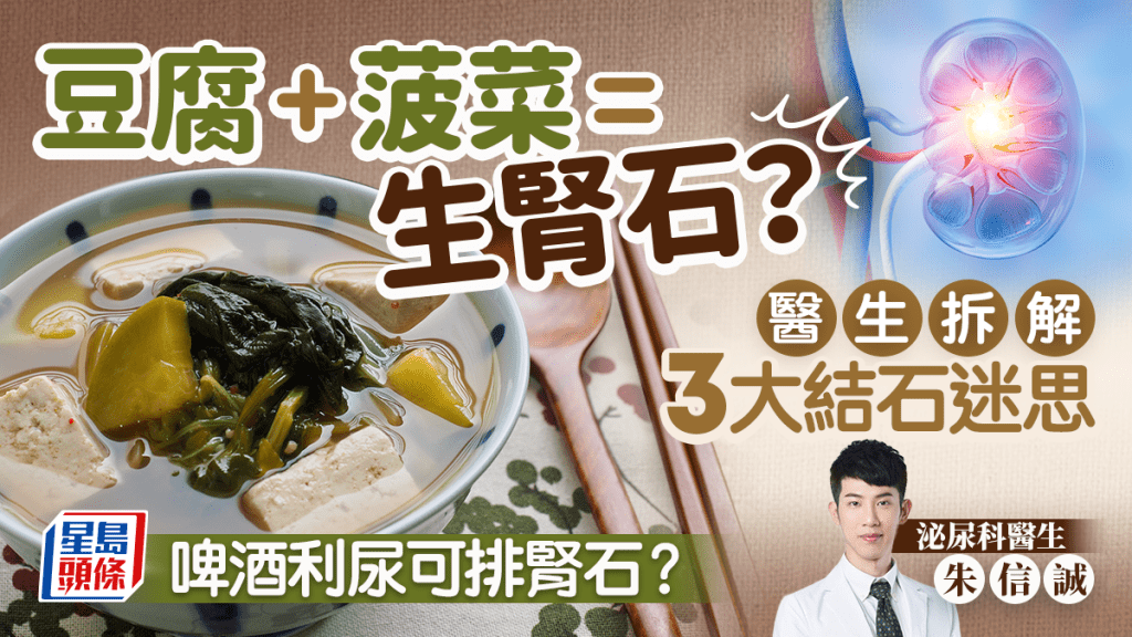 豆腐+菠菜=生腎石？醫生拆解3大結石迷思 啤酒利尿可排腎石？