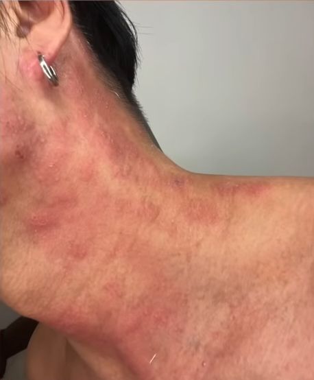 見到都周身痕。