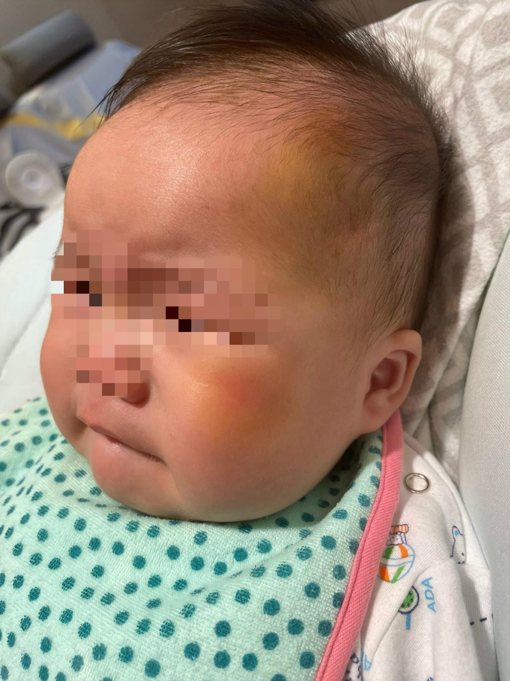 女事主指兒子被賊人打傷。女事主提供