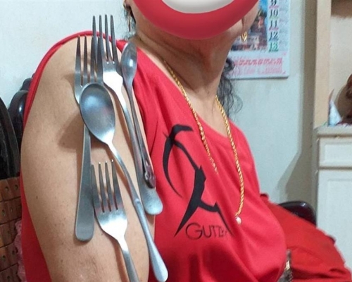 台灣新北市有一名婦人打了莫德納疫苗後，手臂竟可以吸叉子等餐具。網上圖片