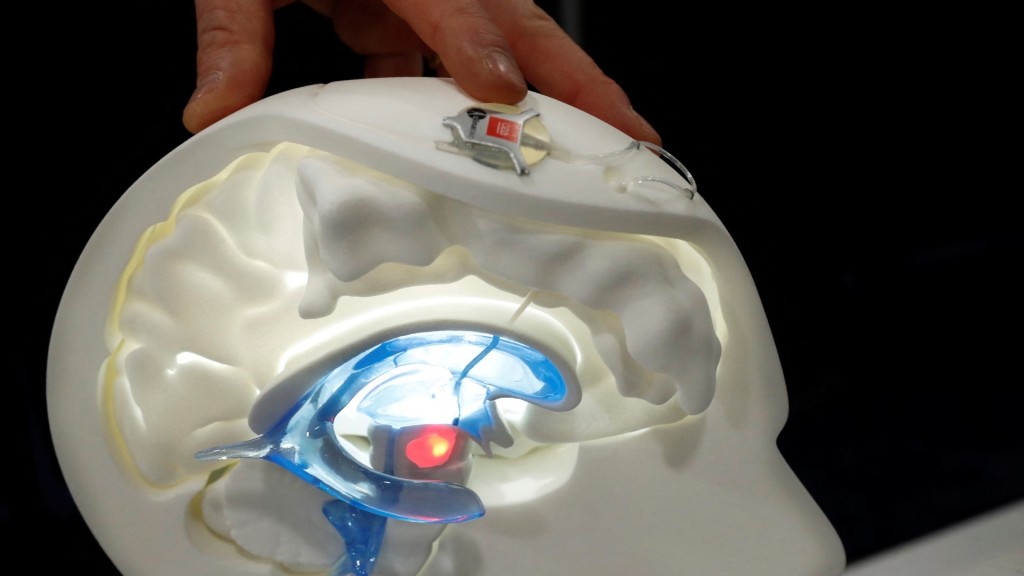 今年1月在美国消费电子展（CES）发布的一款旨在减缓帕金逊症的脑内光学设备。 路透社