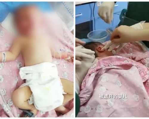 醫護為女嬰清理耳內的蛆蟲。網圖