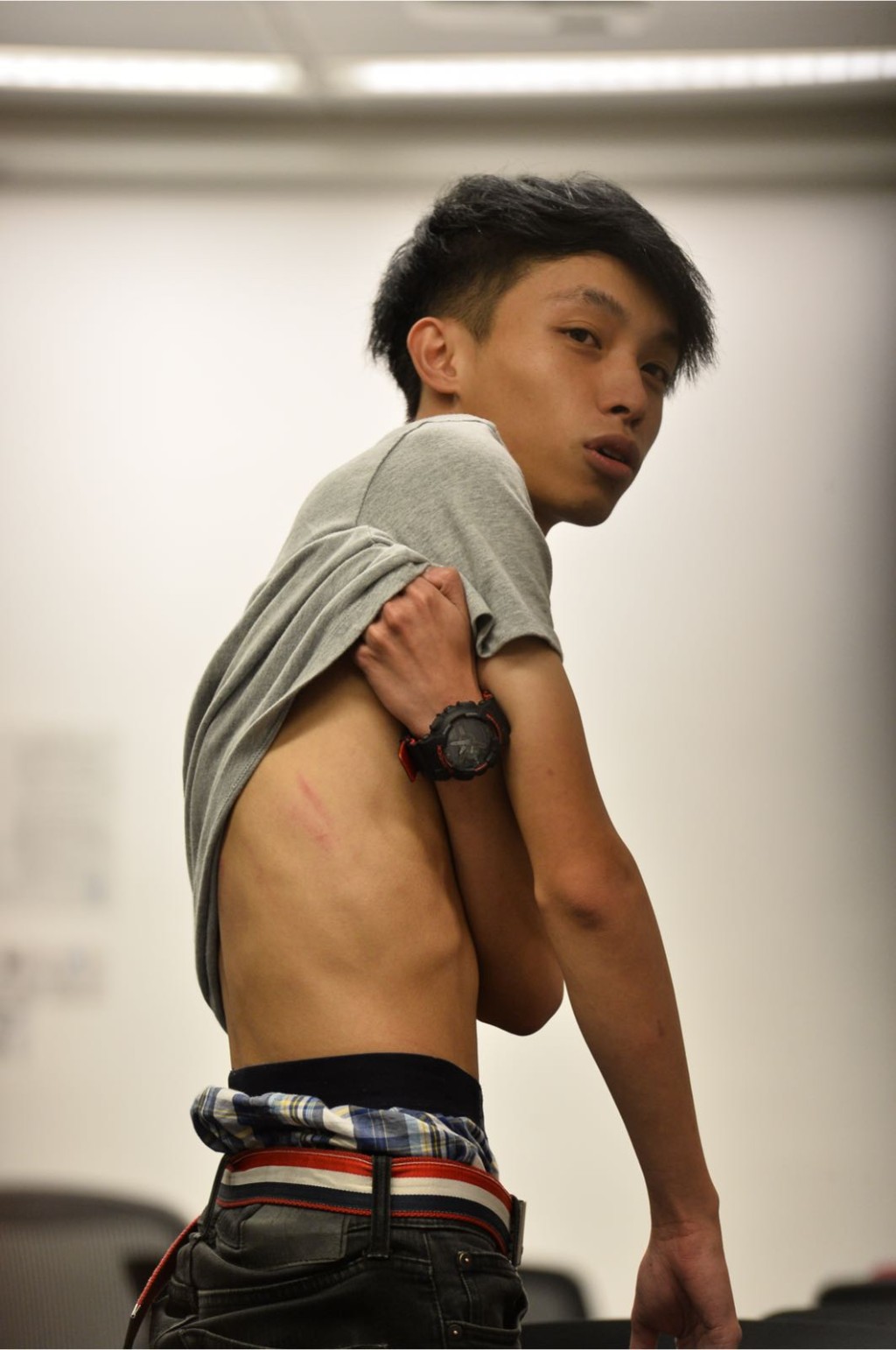 陳皓桓聲稱被警方毆打。