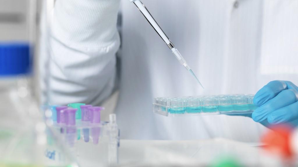 英國男子為逃避贍養費，與DNA檢測中心職員合謀偽造親子鑑定報告。 法新社