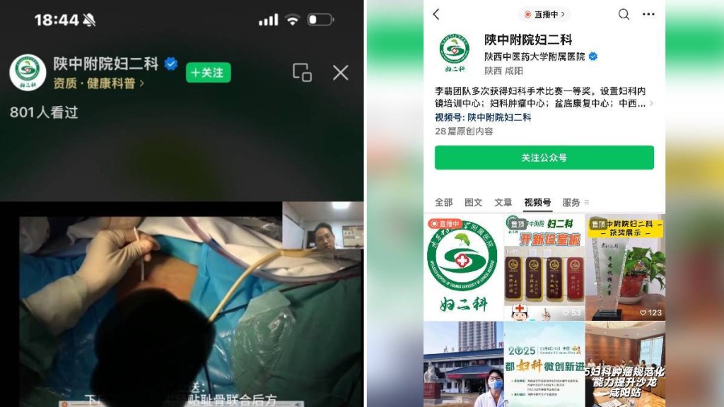 陝西有醫院的婦科做手術直播時，讓病人私隱部位「零格仔」暴露在網民前。抖音
