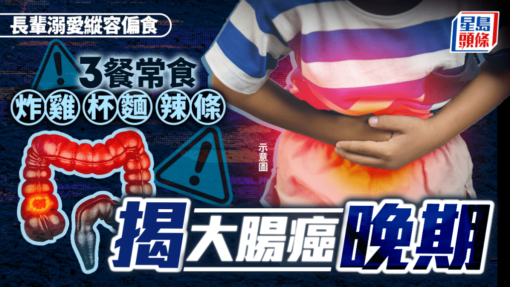 長輩溺愛縱容偏食 3餐常食炸雞杯麵辣條 12歲男童腹痛揭大腸癌晚期