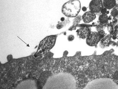顯微鏡下的肺炎支原體。 