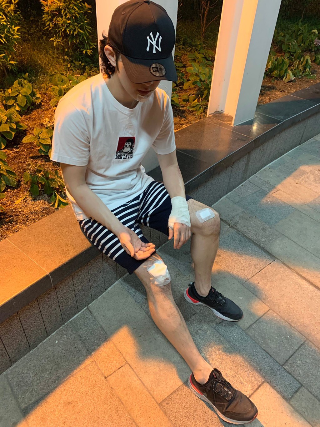 練習過程中發生意外,仆到損手爛腳。