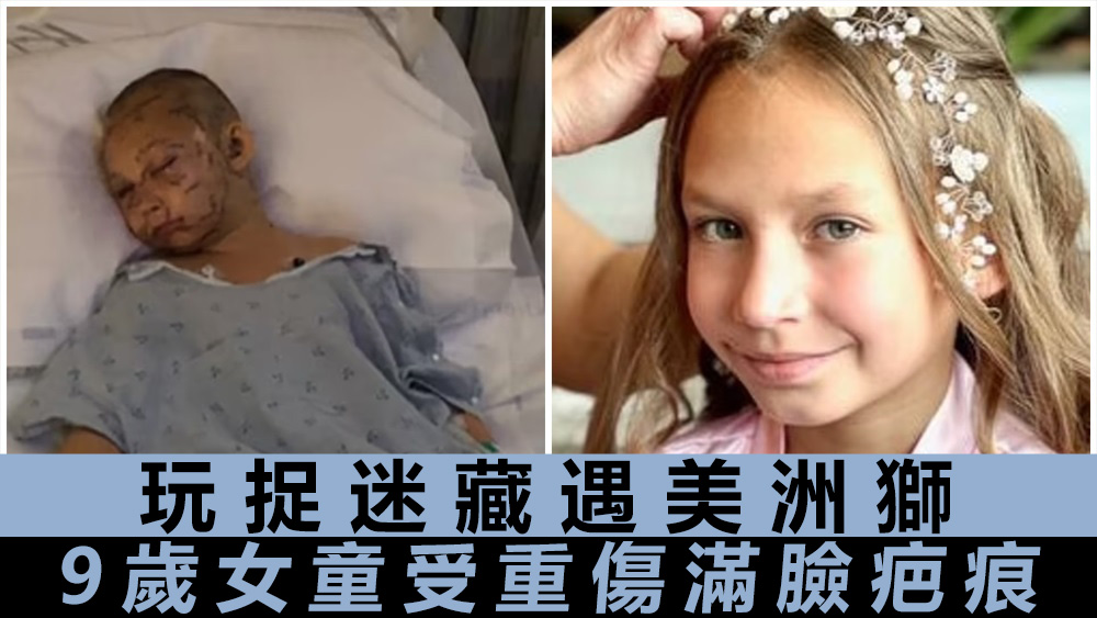 莉莉頭髮被剃光,臉上滿布傷痕。互聯網圖片