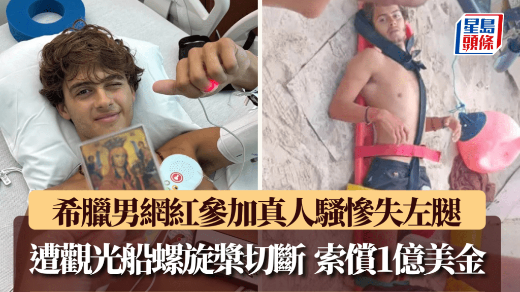希腊男网红参加真人骚遭螺旋桨切断左腿，索偿逾7.8亿港元。
