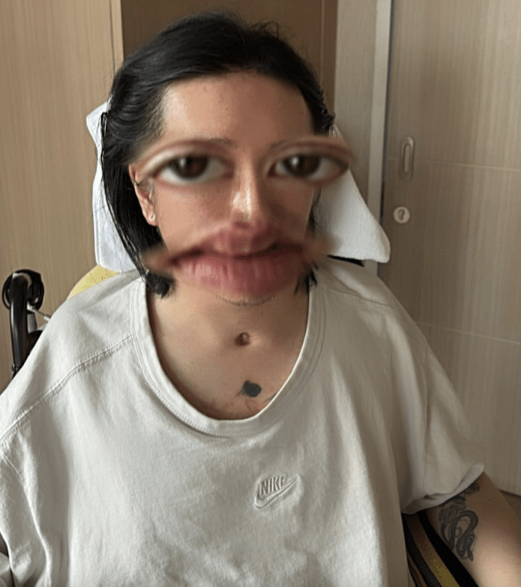 阿Mo最近一次在社交平台发布个人正面照片是在2025年7月,而且是伤后的首次,当时相片经滤镜加工,未能看清楚其伤后的面容。 阿Mo最近一次在社交平台发布个人正面照片是在2025年7月,而且是伤后的首次,当时相片经滤镜加工,未能看清楚其伤后的面容。