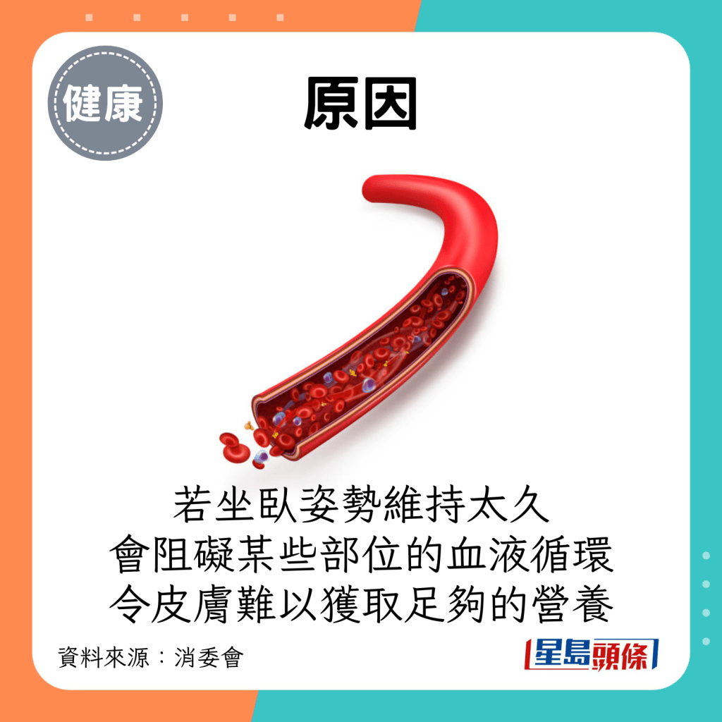 若坐卧的姿势维持得太久，会阻碍该些位置的血液循环，令皮肤难以获取足够的营养。