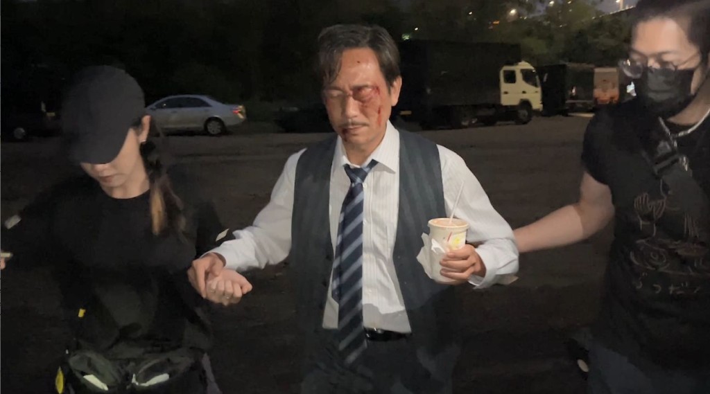 陳國邦化上特效傷妝,連飯也不能吃一口,出入洗手間及現場也得工作人員攙扶。 陳國邦化上特效傷妝,連飯也不能吃一口,出入洗手間及現場也得工作人員攙扶。