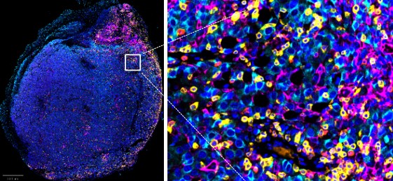 AOAH能與現有免疫療法結合,產生協同效應,增強癌症免疫治療效果。 AOAH能與現有免疫療法結合,產生協同效應,增強癌症免疫治療效果。