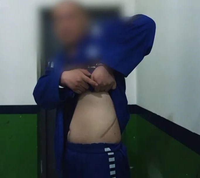 唐某豐因業績欠佳而被割腎。央視截圖 唐某豐因業績欠佳而被割腎。央視截圖