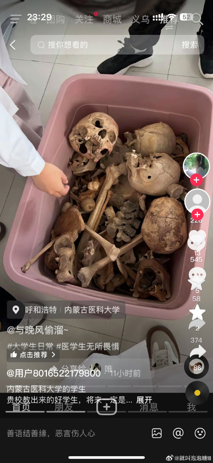 內蒙醫大學生公開與大體老師遺骨合影稱「無懼」。