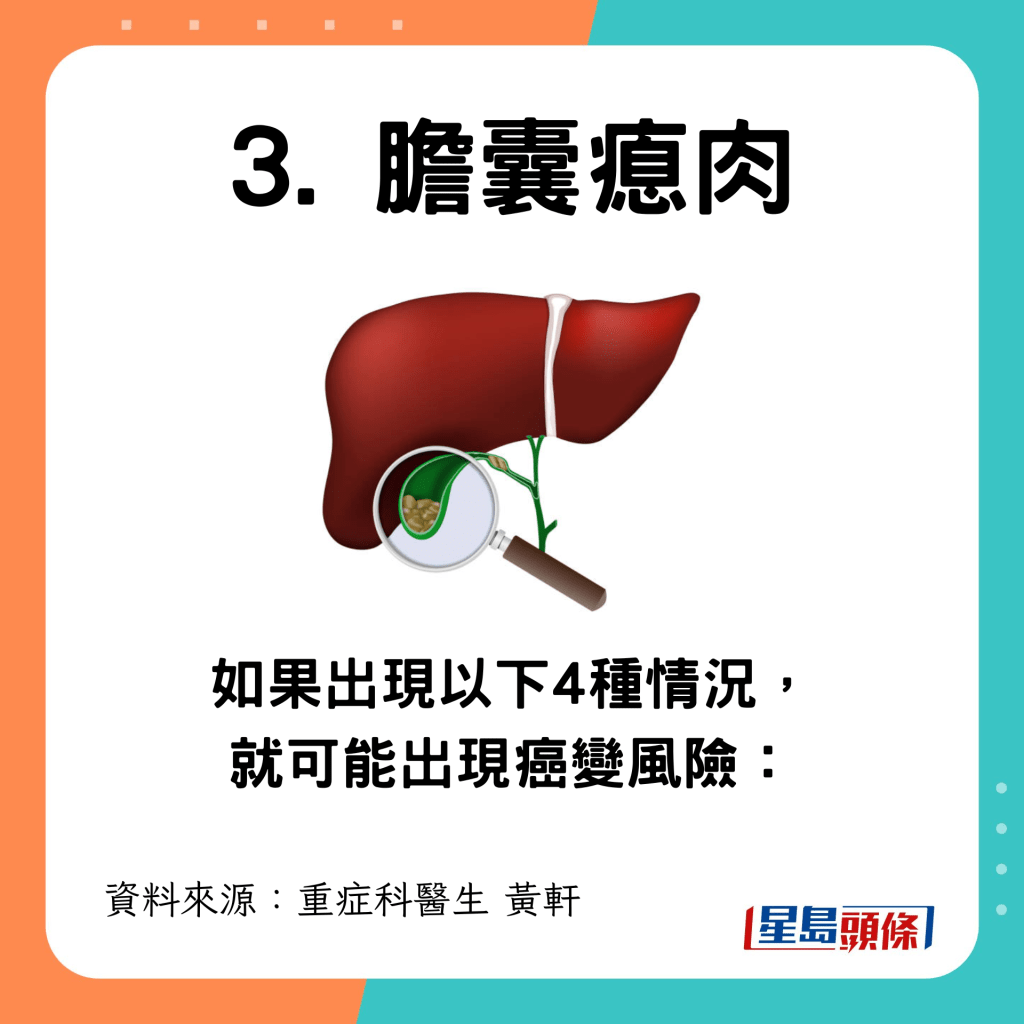 膽囊瘜肉出現4種情況恐癌變