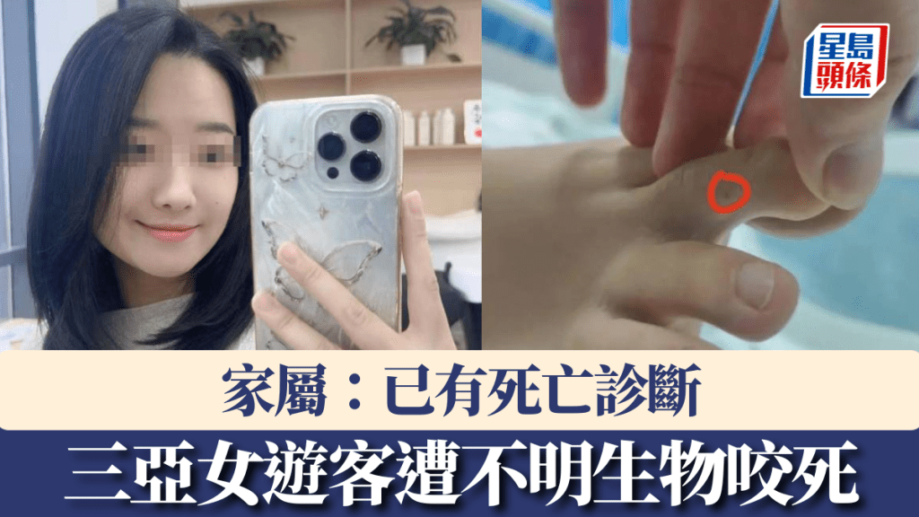 女子三亞被不明物咬傷身亡,家屬證實被蛇咬。