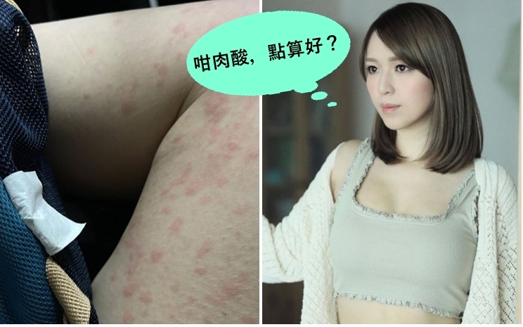 孫慧雪貼出大腿出風癩的相片。