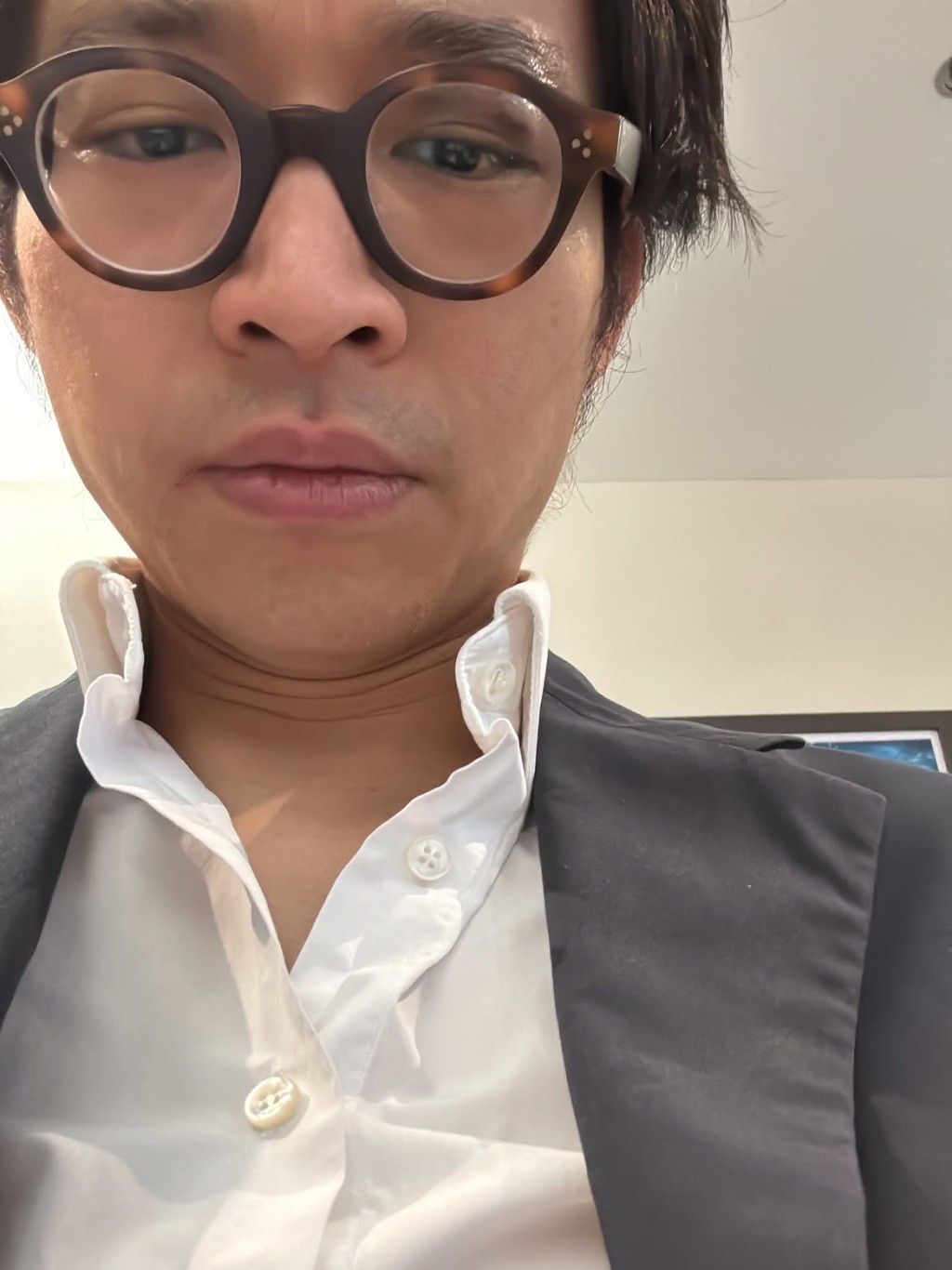 林作戴上厚框眼鏡遮傷勢。 林作戴上厚框眼鏡遮傷勢。