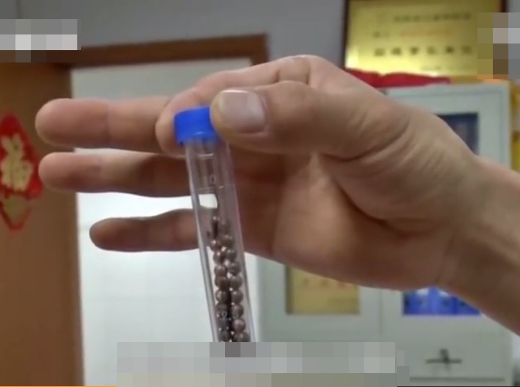 該男生因出於好奇，竟將29顆磁珠塞進自己尿道。網圖