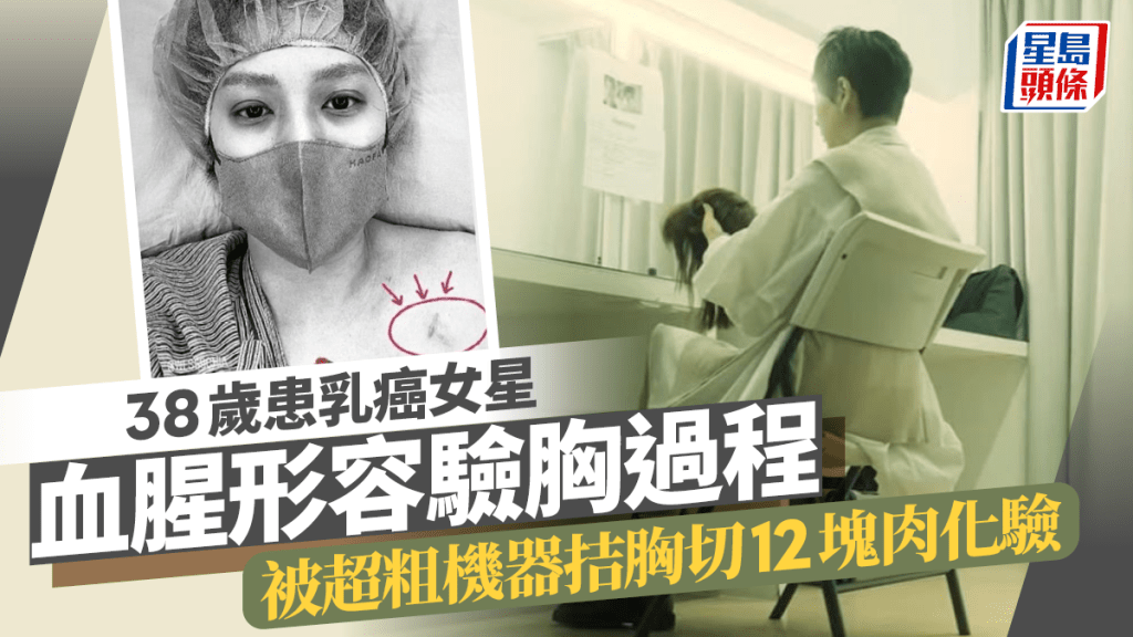 38歲患乳癌女星血腥形容驗胸過程！被超粗機器拮胸切12塊肉化驗  覆診憂復發難忍再化療