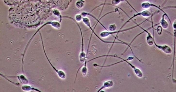研究發現男性若精子量低，家庭成員患癌風險增。路透社