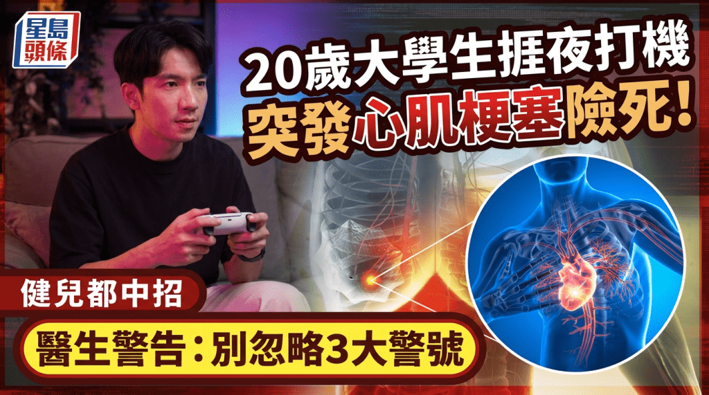20歲大學生捱夜打機 突發心肌梗塞險死！勤做運動健兒都中招  醫生警告：別忽略3大警號