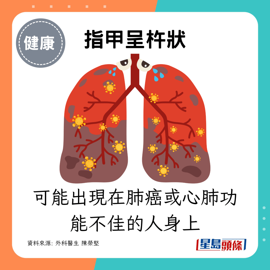 可能出現在肺癌或心肺功能不佳的人身上