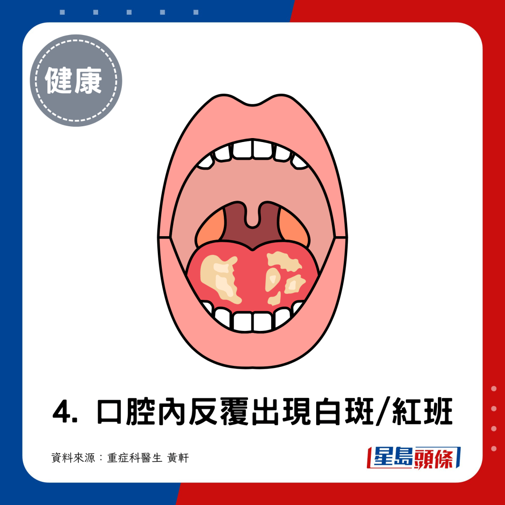 4. 口腔内反覆出现白斑/红班