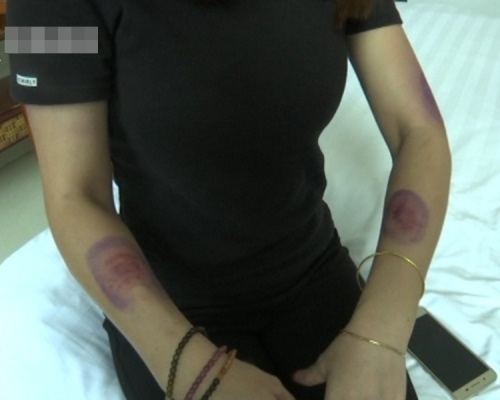 陳女遭楊男正室指派的壯漢毆打。(網上圖片)