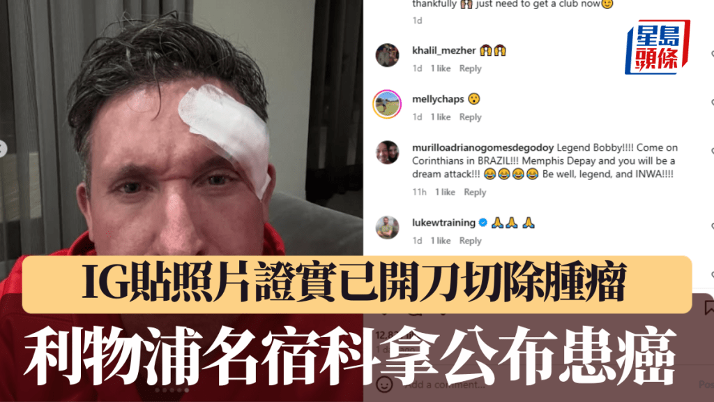 利物浦名宿科拿IG透露患基底細胞癌，並已開刀切除腫瘤。科拿IG