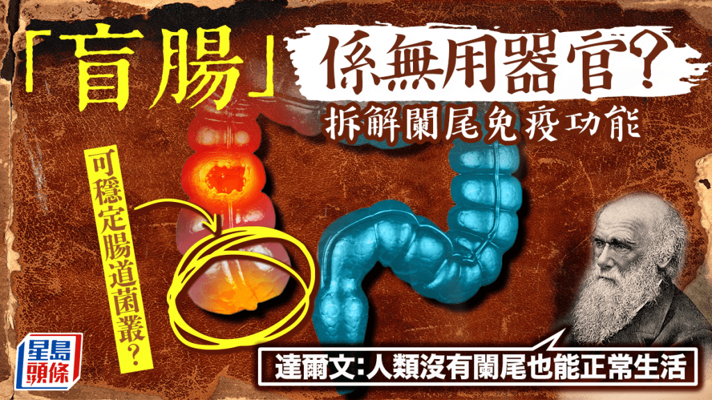 「盲腸」係無用器官？拆解闌尾免疫功能 現代科學揭可穩定腸道菌叢