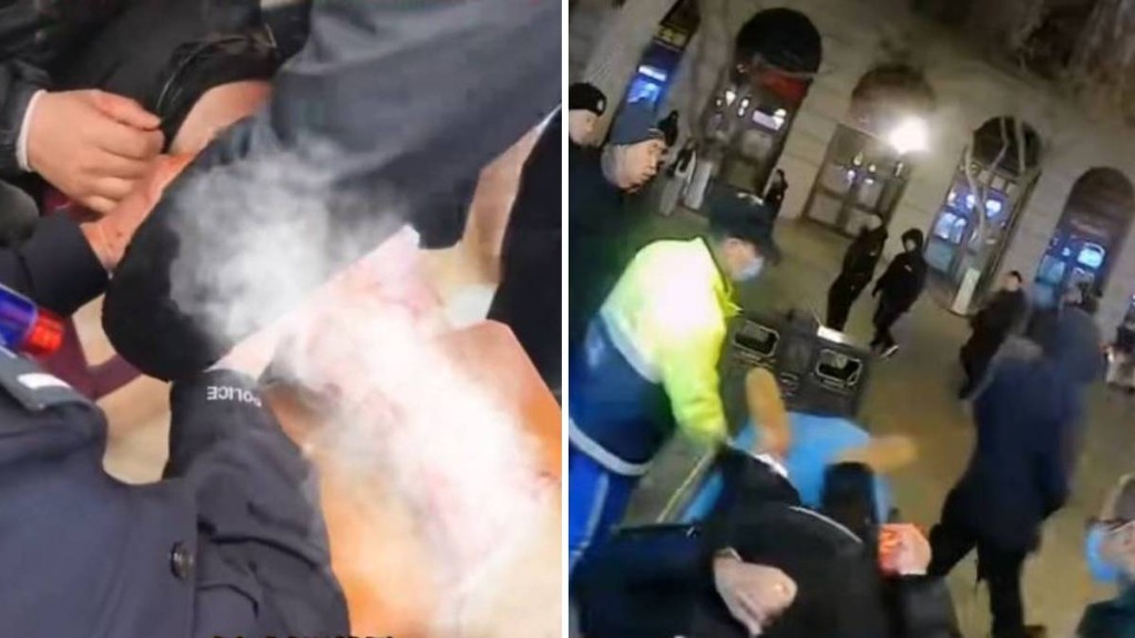 南方遊客未著打底褲，在哈爾濱-20℃氣溫下，凍爆靜脈曲張的血管。平安哈爾濱