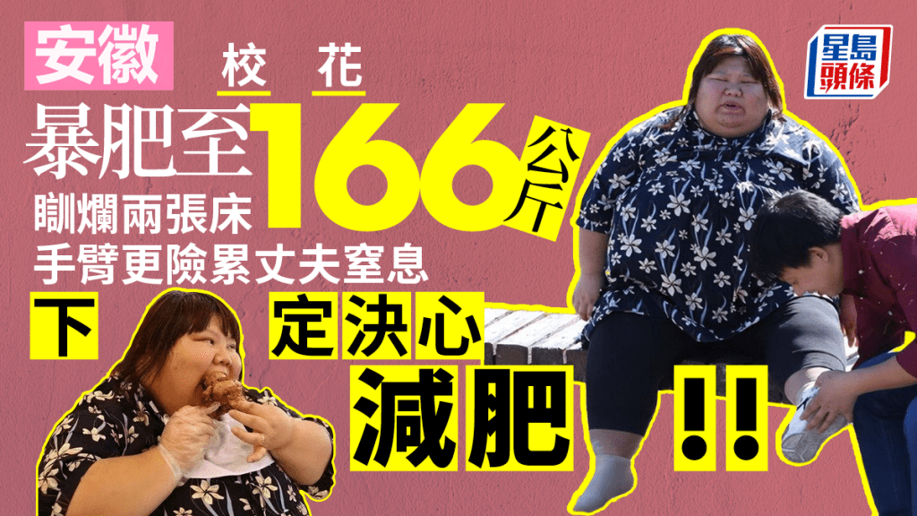 安徽校花暴肥至166公斤,差點害丈夫睡眠窒息,為愛減肥現成果。