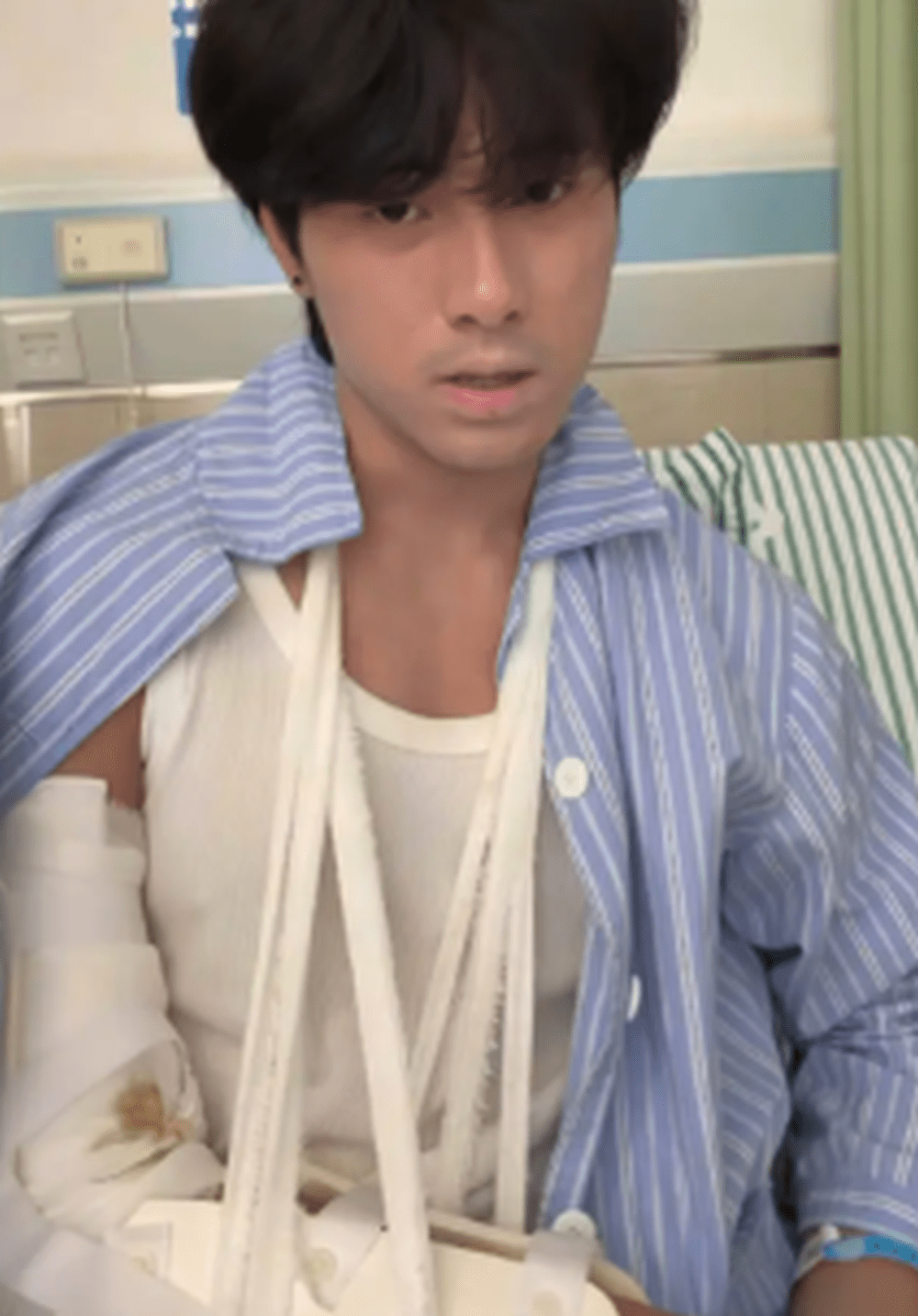 被「出術」遊客拗手瓜「斷臂」NPC是一級運動員。 被「出術」遊客拗手瓜「斷臂」NPC是一級運動員。
