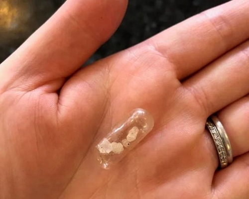 该胶囊内有著可疑的水晶晶体。网图
