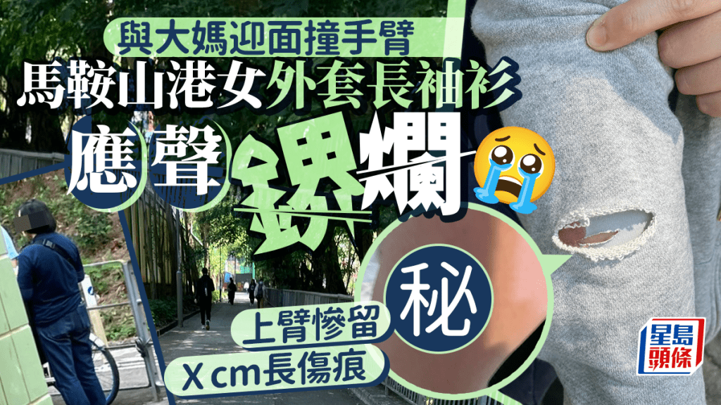 與大媽迎面撞手臂 馬鞍山港女外套長袖衫應聲鎅爛 上臂留Ｘcm長傷痕