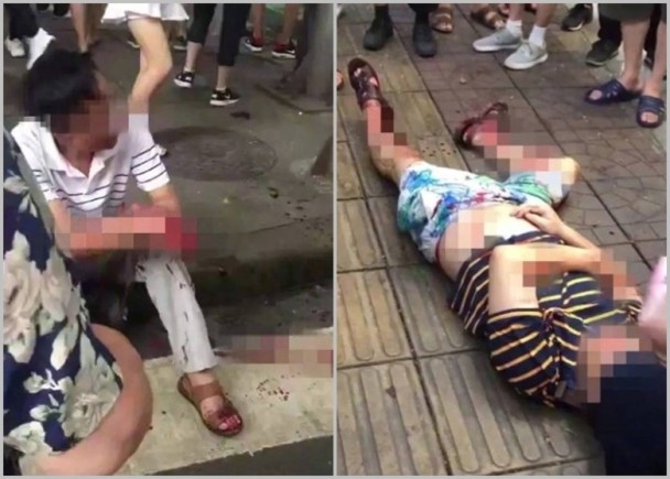 多名乘客受傷等待救緩。(網圖)