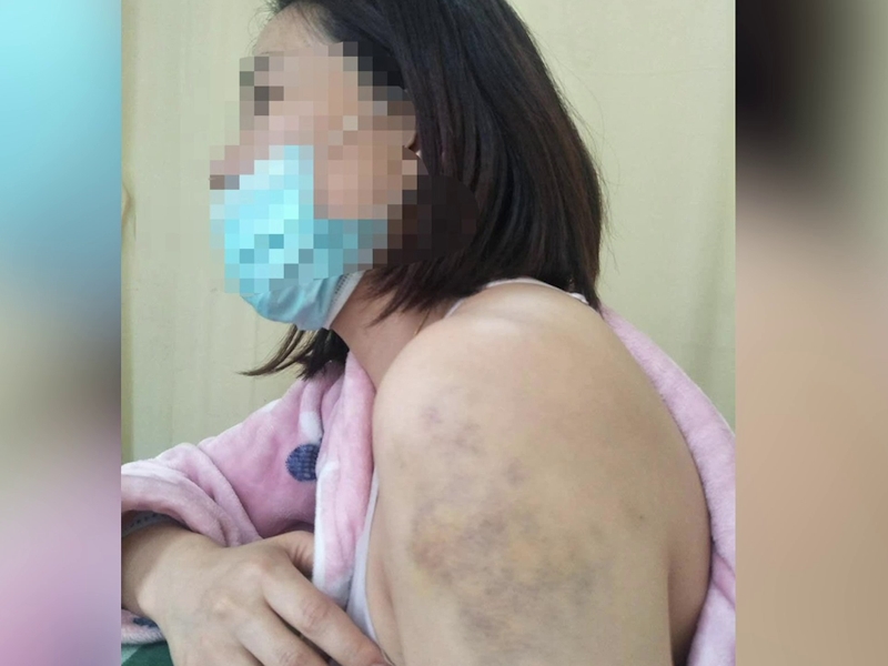 女子稱已經被家暴了16年,每次都被打的渾身是傷,青一塊紫一塊。(網圖)