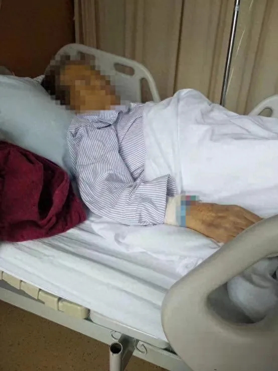 机械臂切除肿瘤不全，二次手术后病人两年后亡。