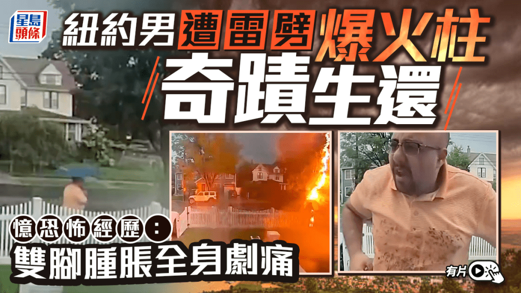 有片｜紐約男出門遭雷劈中奇蹟生還 憶恐怖經歷：雙腳腫脹全身劇痛